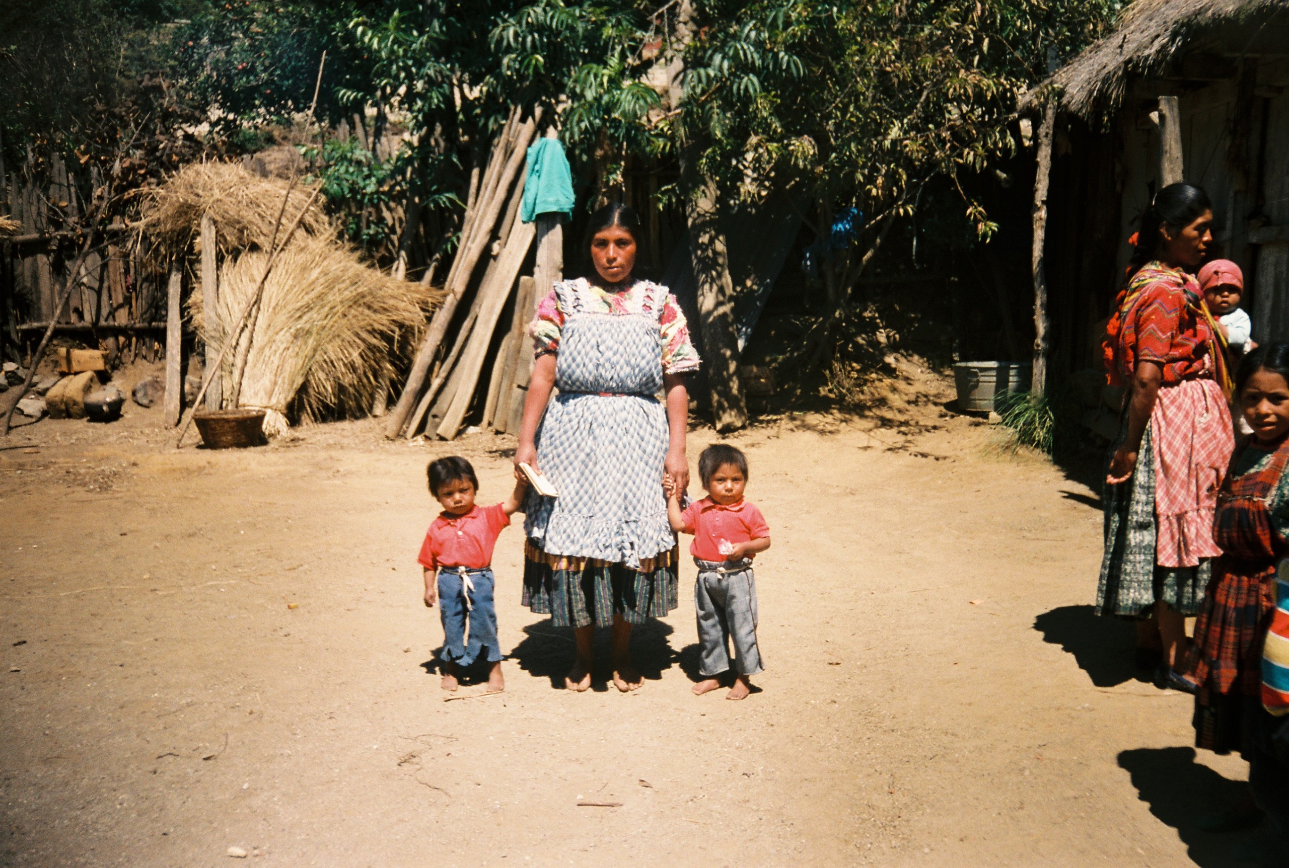 Writes Malloy: These two boys appear of similar age, but one was two years older than his brother. The elder boy’s growth was stunted due to early childhood illness.