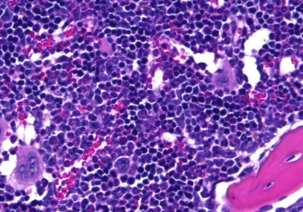 Margaret Murdoch Pink and Purple cells in a microscopic view