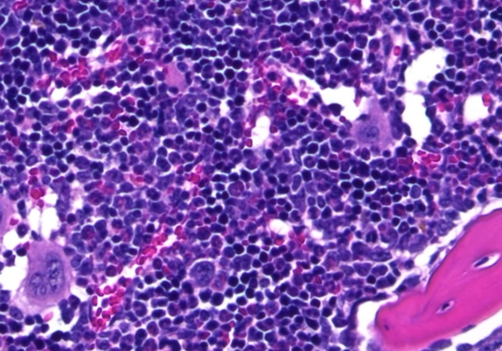 Pink and Purple cells in a microscopic view