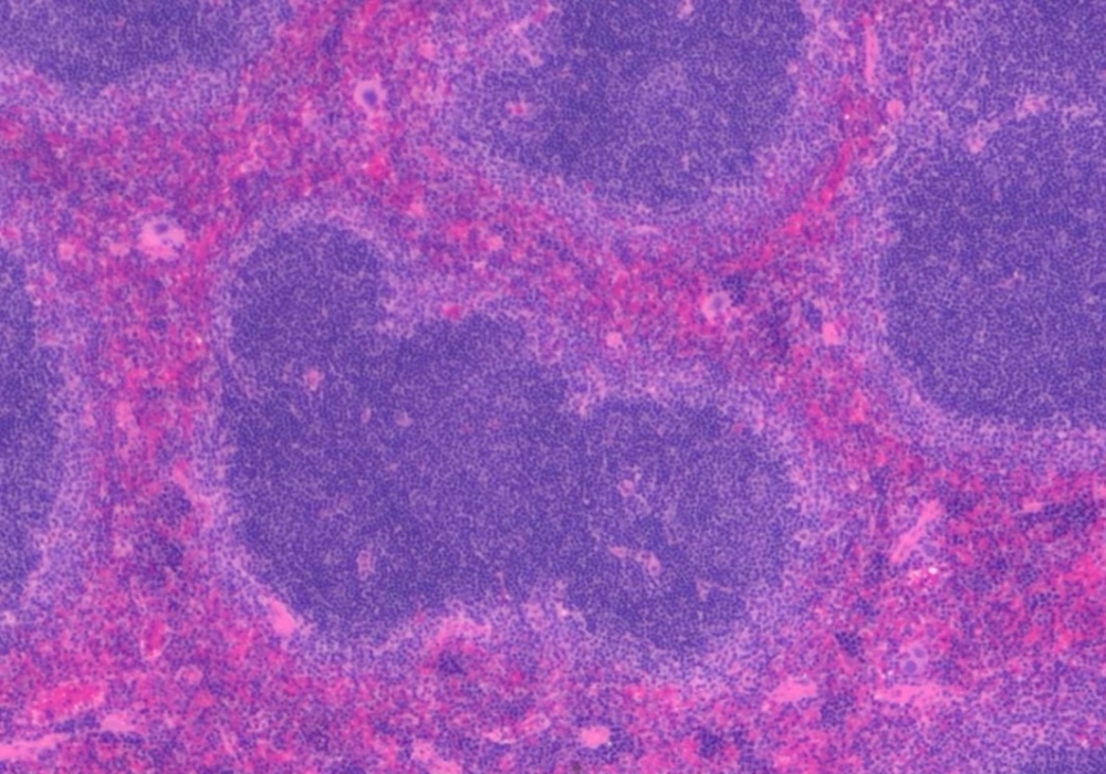 Pink and Purple cells in a microscopic view