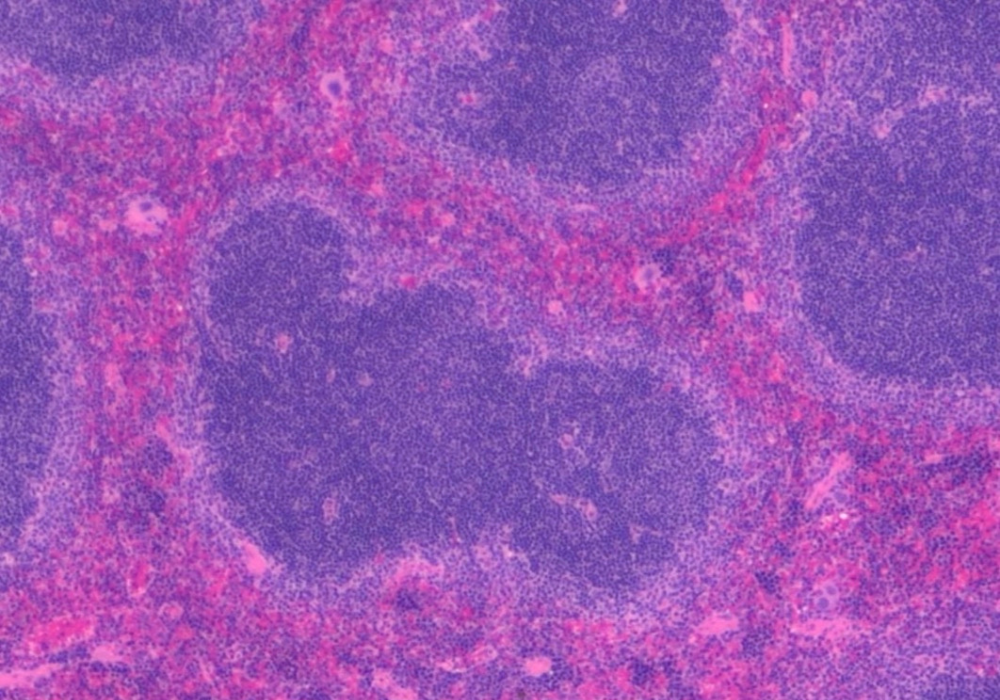 Margaret Murdoch Pink and Purple cells in a microscopic view