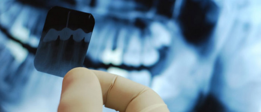 general_dentistry close up of tooth xray